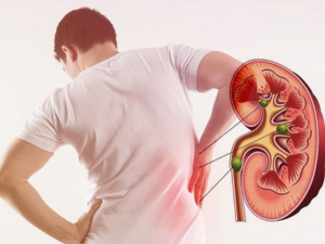 Kidney Stone Treatment in Bathinda